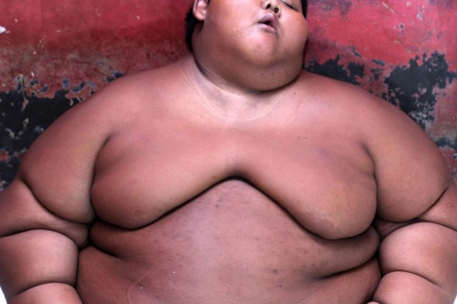 Самый толстый мальчик в мире