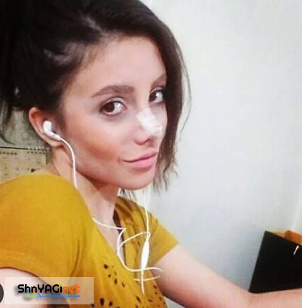 Девушка из Ирана по имени Сахар Тарбан перенесла 50 операций, чтобы стать п ...