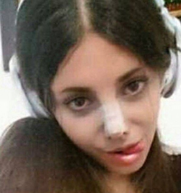 19-летней девушки из Ирана изуродовала себя в погоне стать похожей на Андже ...