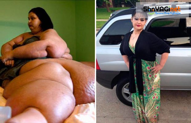 Самой тяжелой женщине в мире удалось сбросить 400 кг