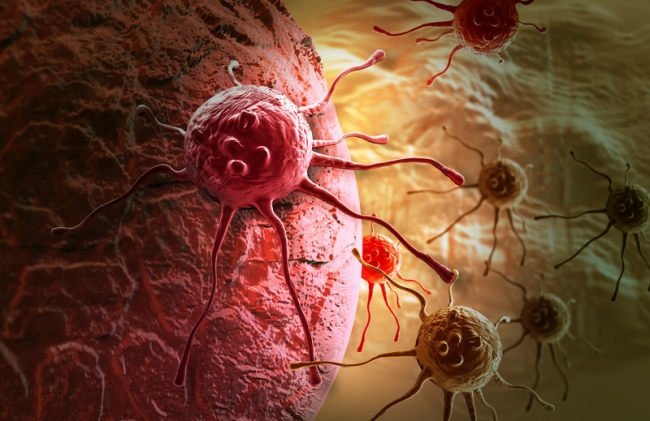 Синтезированная клетка уничтожает раковую опухоль изнутри