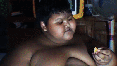Что случилось с самым толстым мальчиком в мире
