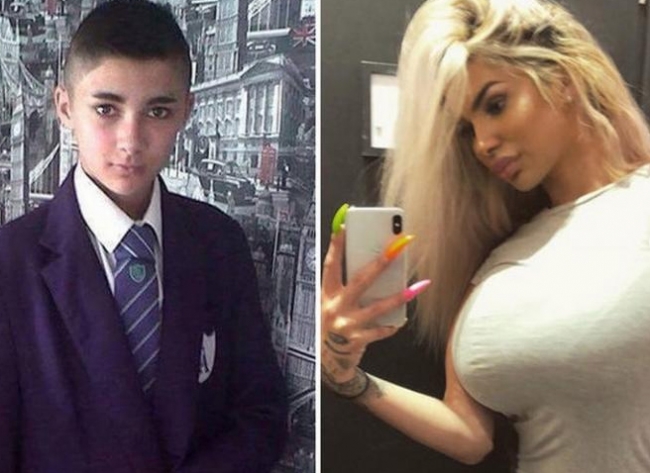Подросток потратил £15000, чтобы стать похожим на Ким Кардашьян