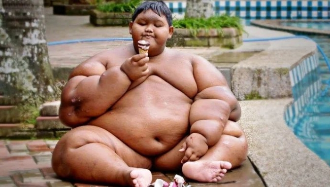 Что случилось с самым толстым мальчиком в мире